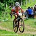 Burry Stander (Specialized Racing) showing the evidence of his crash 		CREDITS: Rob Jones 		TITLE: World Cup Mont Ste-Anne 		COPYRIGHT: Rob Jones/www.canadiancyclist.com 2011� All rights retained - no copying, printing or other manipulation, editing or pr